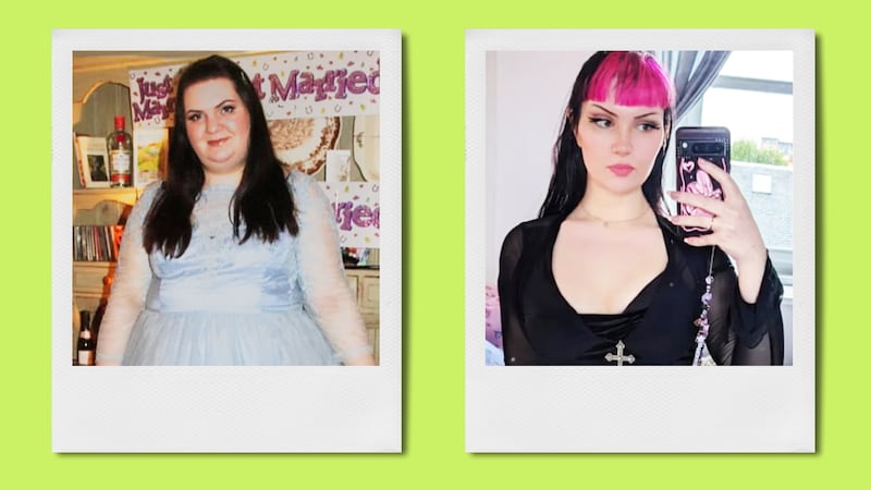I Had 10 Surgeries to Fix My Body Dysmorphia Looker