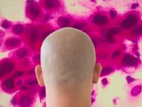 articles/2013/07/31/you-don-t-actually-have-cancer/130731-cancer-epstine-tease_m8lrsb