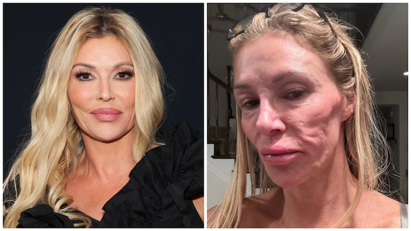 Brandi Glanville in April and in December 2024.