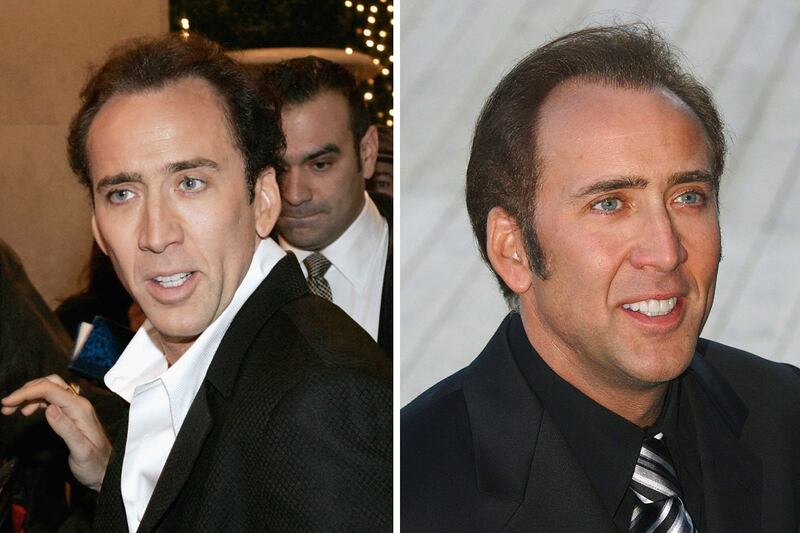 galleries/2011/09/27/stars-who-suddenly-have-hair-travolta-costner-alexander-cryer-photos/stars-who-suddenly-have-hair-gal-cage_qbfxiw