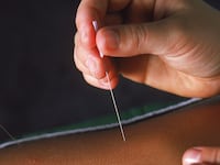 200912-Candida-grisly-backstory-acupuncture-tease_tdd3kq