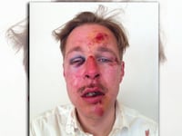 articles/2013/04/12/wilfred-de-brujin-and-france-s-scary-gay-marriage-backlash/130412-giovanni-france-gay-tease-embed_tq6cps