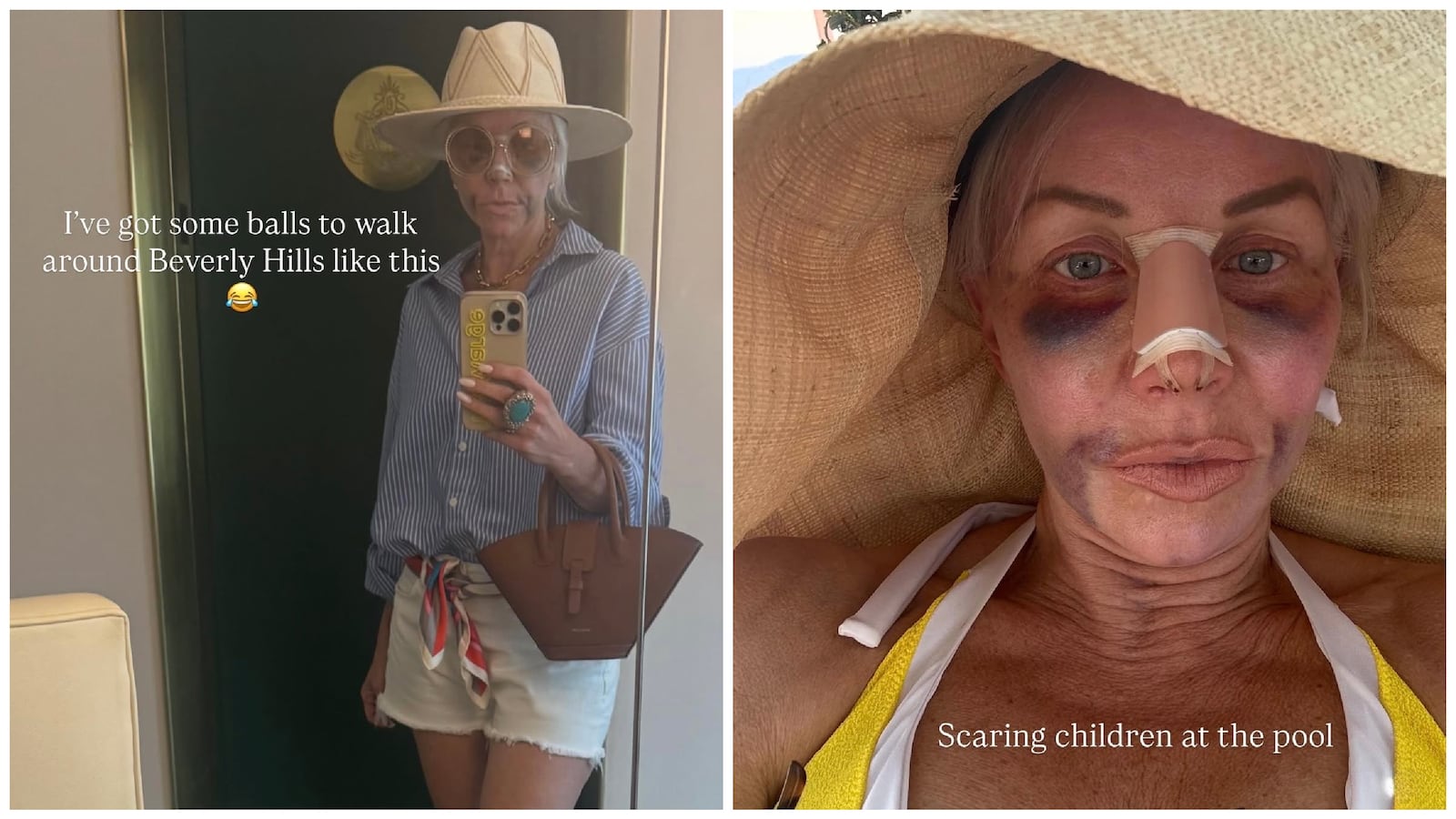 Plastic surgery Margaret Josephs