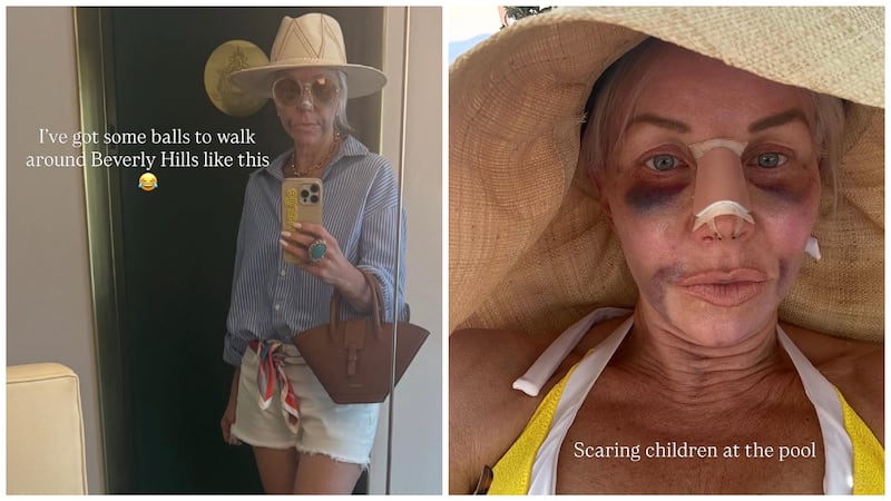 Plastic surgery Margaret Josephs