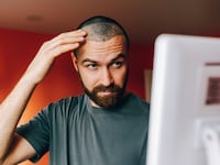 Man examining his scalp after a follicular unit extraction hair transplant while looking in mirror