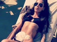 articles/2014/07/02/the-brave-colostomy-bag-selfies/140701-lytton-chrons-tease_d9zy1c