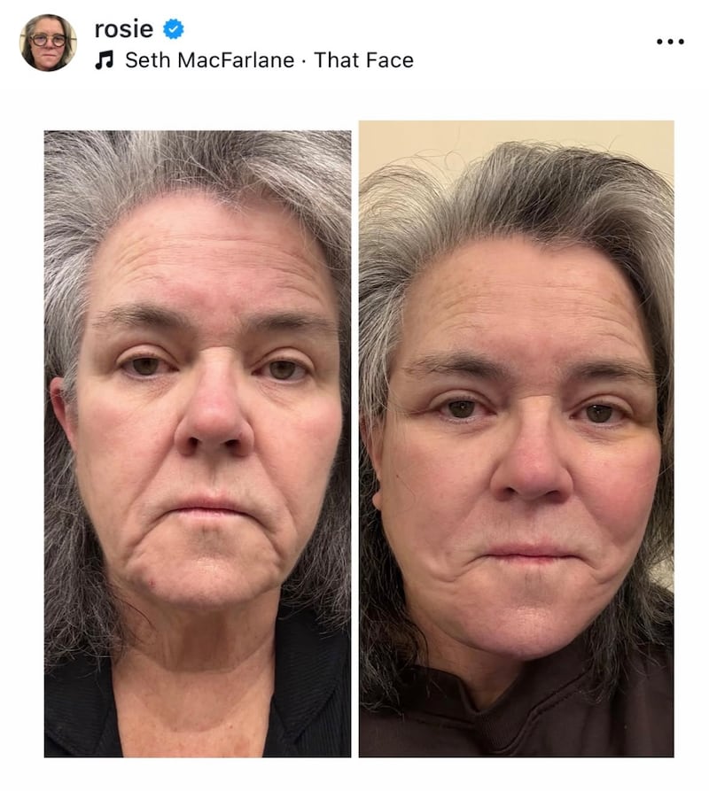 On Wednesday, Rosie O'Donnell published her before-and-after photos side by side on Instagram.