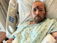 Jason’s daughter Ashley Turner shared this image of her dad after the horrific incident.
