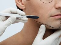 A man undergoes a cosmetic surgery consultation, with markings drawn onto his face.