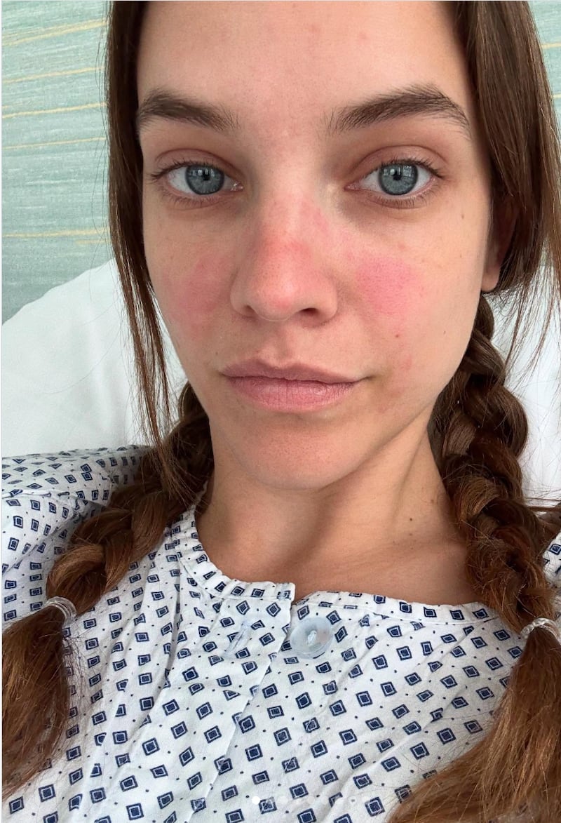 Barbara Palvin shares a picture of herself in a hospital gown after undergoing surgery for endometriosis in 2025.