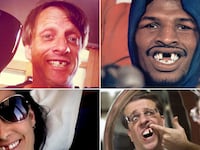 galleries/2011/08/26/toothless-celebrity-smiles-tony-hawk-demi-moore-jim-carrey-more-photos/toothless-smiles-tease_hcitiu