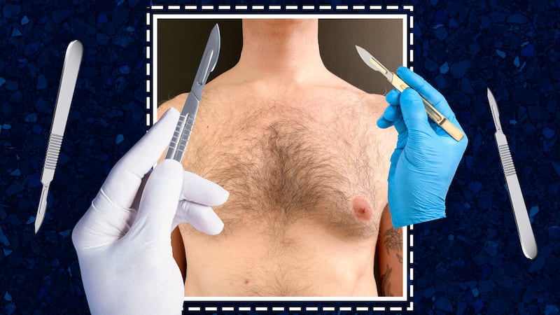 The Looker illo illustration for - This Plastic Surgery Gave Him The Confidence to Change Jobs