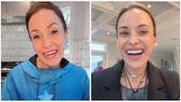 Audrey Zona said she felt frustrated not being able to recognize herself after having plastic surgery.