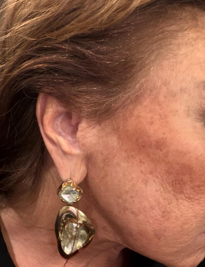 Abby Lee Miller's statement earrings stretched her earlobes, leaving them at the edges of her ears.