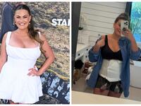 Brittany Cartwright in September 2025 (L) and during the healing process in October 2025.