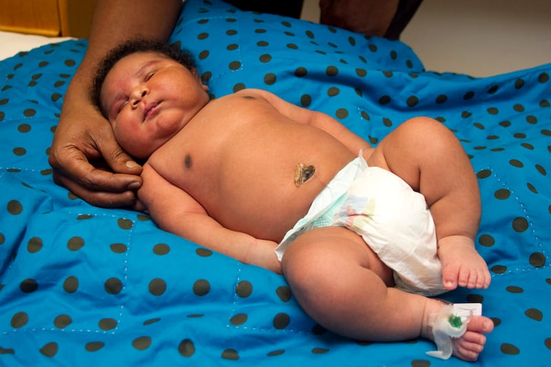 articles/2011/07/13/the-16-pound-baby-bigger-ain-t-always-better/jamichael-brown-big-babies_hj7viu