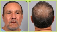 Male hair transformation before and after