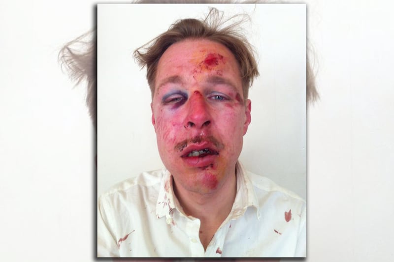 articles/2013/04/12/wilfred-de-brujin-and-france-s-scary-gay-marriage-backlash/130412-giovanni-france-gay-tease-embed_fahbo1