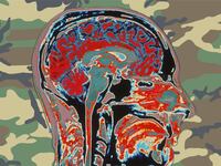 articles/2014/07/23/dysfunctional-congress-prepares-to-claim-another-victim-injured-veterans/140722-mak-brain-tease_y7qgyo