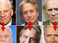 galleries/2011/10/05/simon-cowell-steve-martin-male-stars-rumored-plastic-surgery-photos/plastic-surgery-men-tease_lfhtby