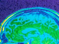 articles/2009/12/10/illustrating-the-brain/schwartz-mri-brain-technology_68747_i3pxls