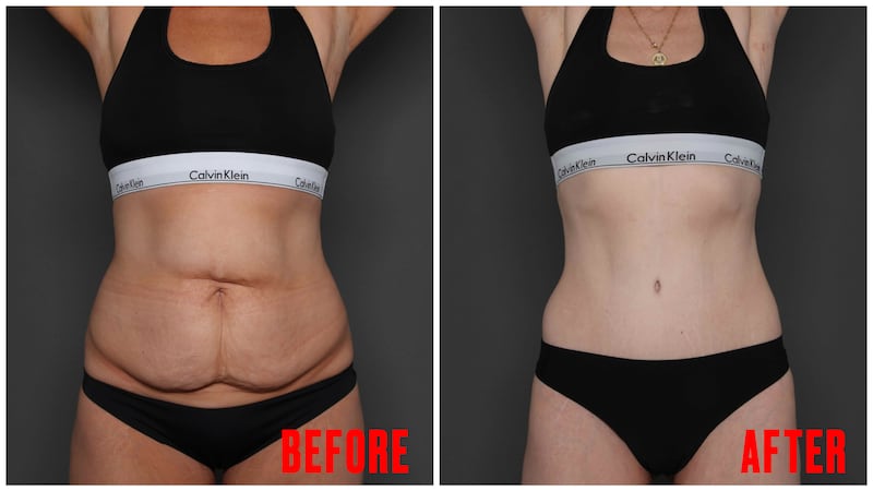 Body Transformation before and after images