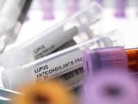 Lupus medicine