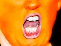 Photo illustration of Donald Trump yelling