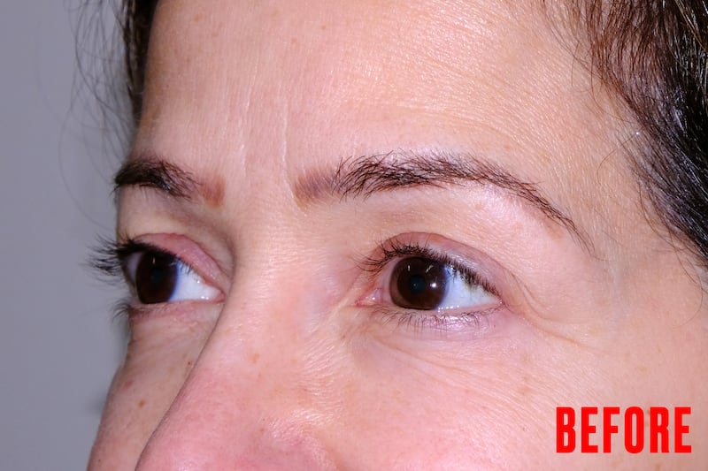 Eyebrow Tranformation