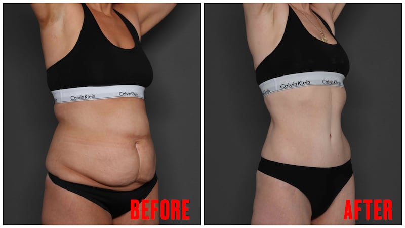 Body Transformation before and after images