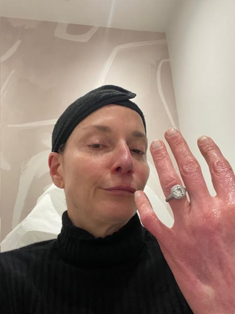 Jill Lewis showing off her hands