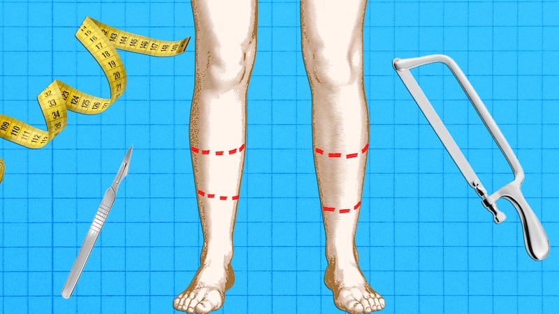 A photo illo illustration for The Looker of legs and surgical tools.