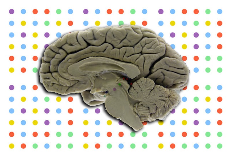 articles/2013/06/20/sorry-folks-playing-dots-won-t-make-you-smarter/130619-sepkowitz-dots-tease_qlukw8