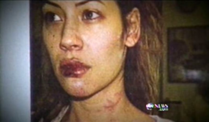 brittany-ashland-abuse-picture_w3skrv