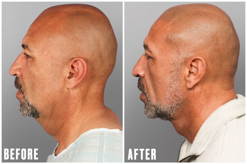 Why This Office Wardrobe Staple Is Driving Men to Get Plastic Surgery for The Looker