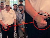 Trump hand shows discoloration in photos posted on X.