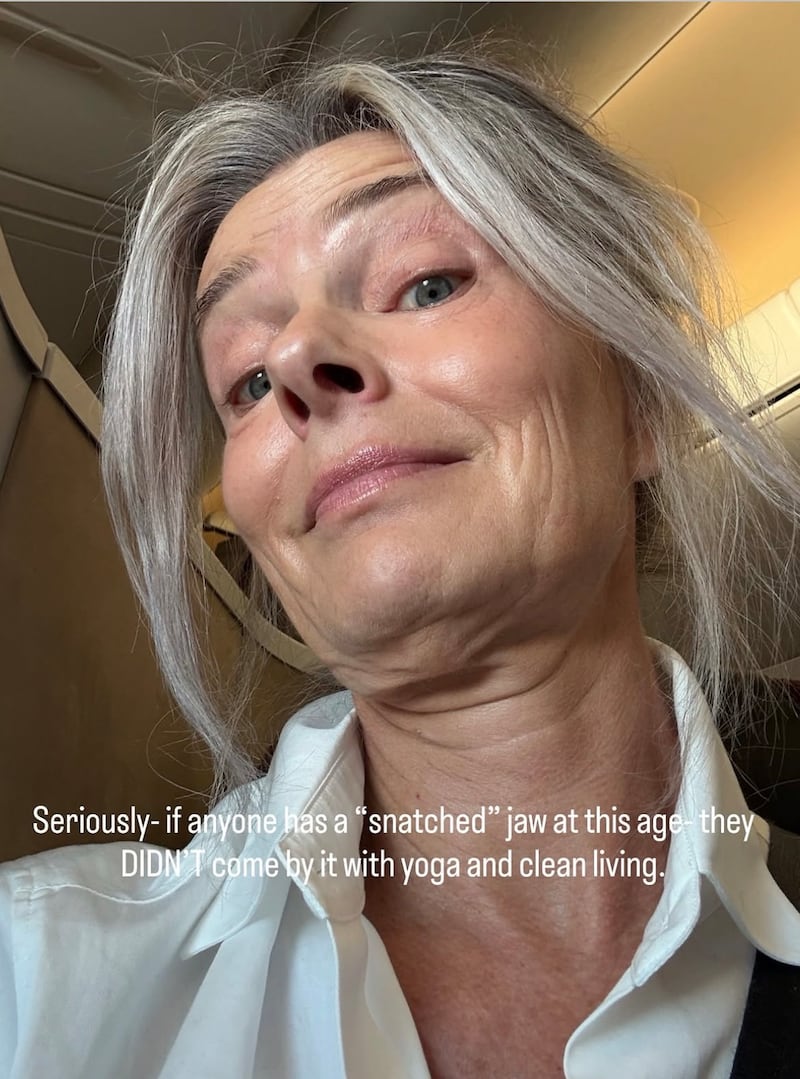 Paulina Porizkova called out people who claim to have a sharp jawline as they age without cosmetic interventions.