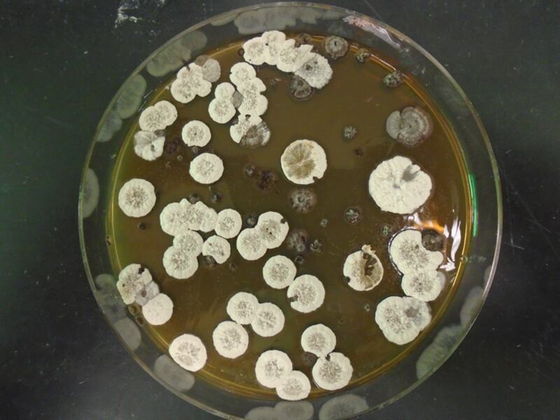 Low-Res_The_common_bacteria_streptomyces_which_makes_the_cyclopropane-containing_molecules_CREDIT_Pablo_Morales-Cruz_1.JPG_gzhrwv