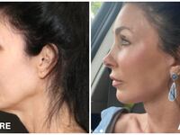 Before-and-after photos of Dr. Nayak's transformation on a client.