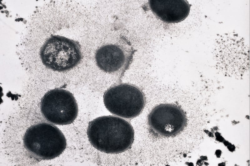 articles/2012/09/28/new-york-s-meningococcus-scare-outbreak-in-gay-community/meningitis-gay-community-sepkowitz_vbnite