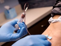 A blood test being conducted with a vial to receive blood