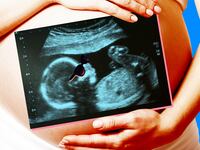 180530-ogrady-fetuses-recognize-faces-hero_t0co9y