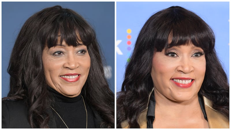 Harry in May 2025 (left) and in November 2025, after undergoing surgery with Dr. Davis.