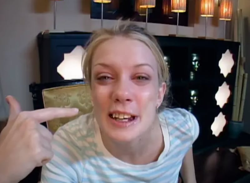 The moment when Sprague cried and said, “Look at my teeth!” after her surgery, was one of the most famous moments of the season.