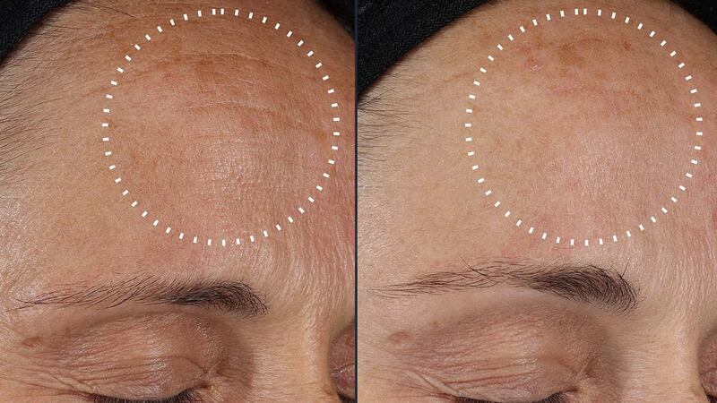 Before and after images of a woman's forehead showing the results of using Medik8's Crystal Retinal. The "after" shows a reduction in wrinkles, fine line, texture, dullness, and dark spots.