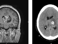2017-07-20T214838Z_488846854_RC11176340C0_RTRMADP_3_USA-JOHNMCCAIN-GLIOBLASTOMA_qcfhh9