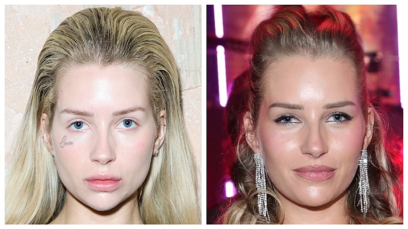 Lottie Moss's "Lover" tattoo in February 2024; Lottie Moss without her "Lover" tattoo in February 2026.