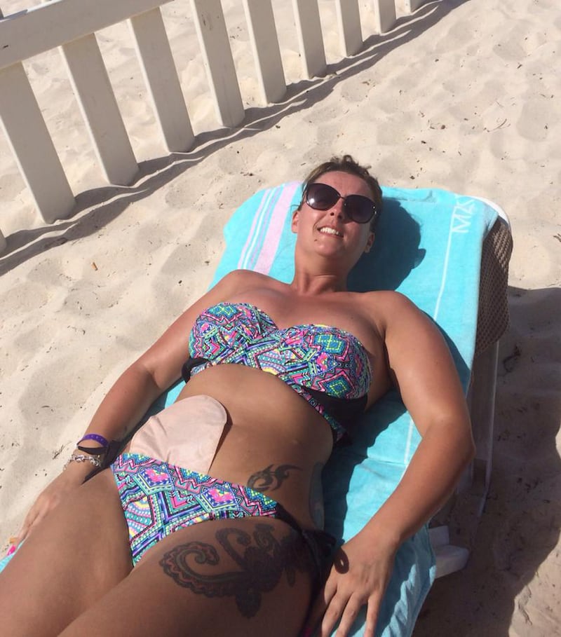 articles/2014/07/02/the-brave-colostomy-bag-selfies/140701-lytton-chrons-embed1_ez76mv