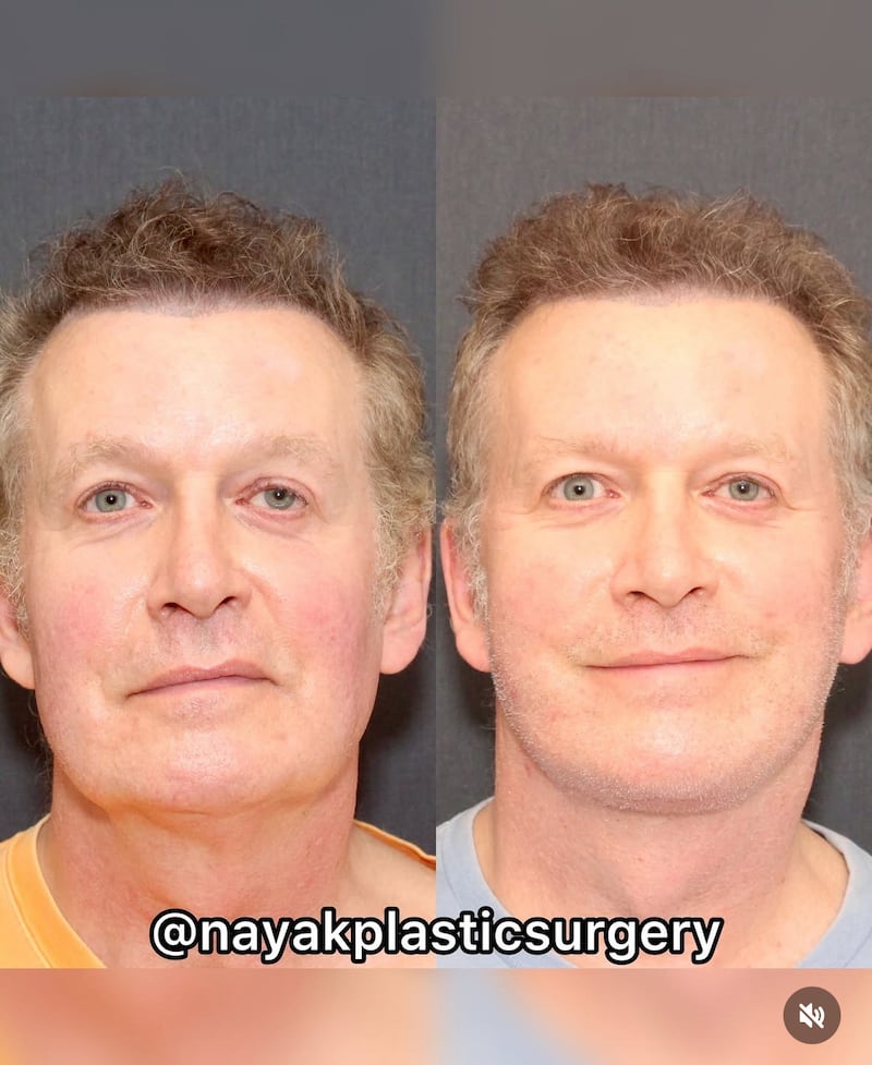 Before-and-after photos of John Spaedy.