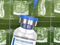 ms multiple sclerosis disease autoimmune t cell testosterone men women difference gender